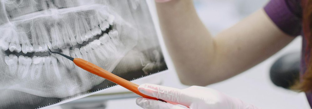 ¿Es Seguro Hacerse una Radiografía con Brackets?