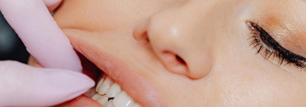 Microimplantes Dentales: Pequeños Aliados para tu Sonrisa